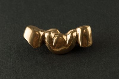 dental-centres-dental-crowns-steel-coated